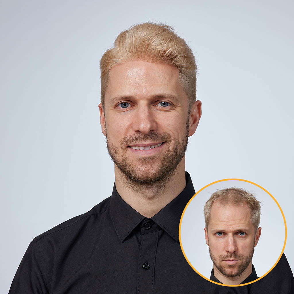 HS1 0.08mm Thin Skin Hair System (8)