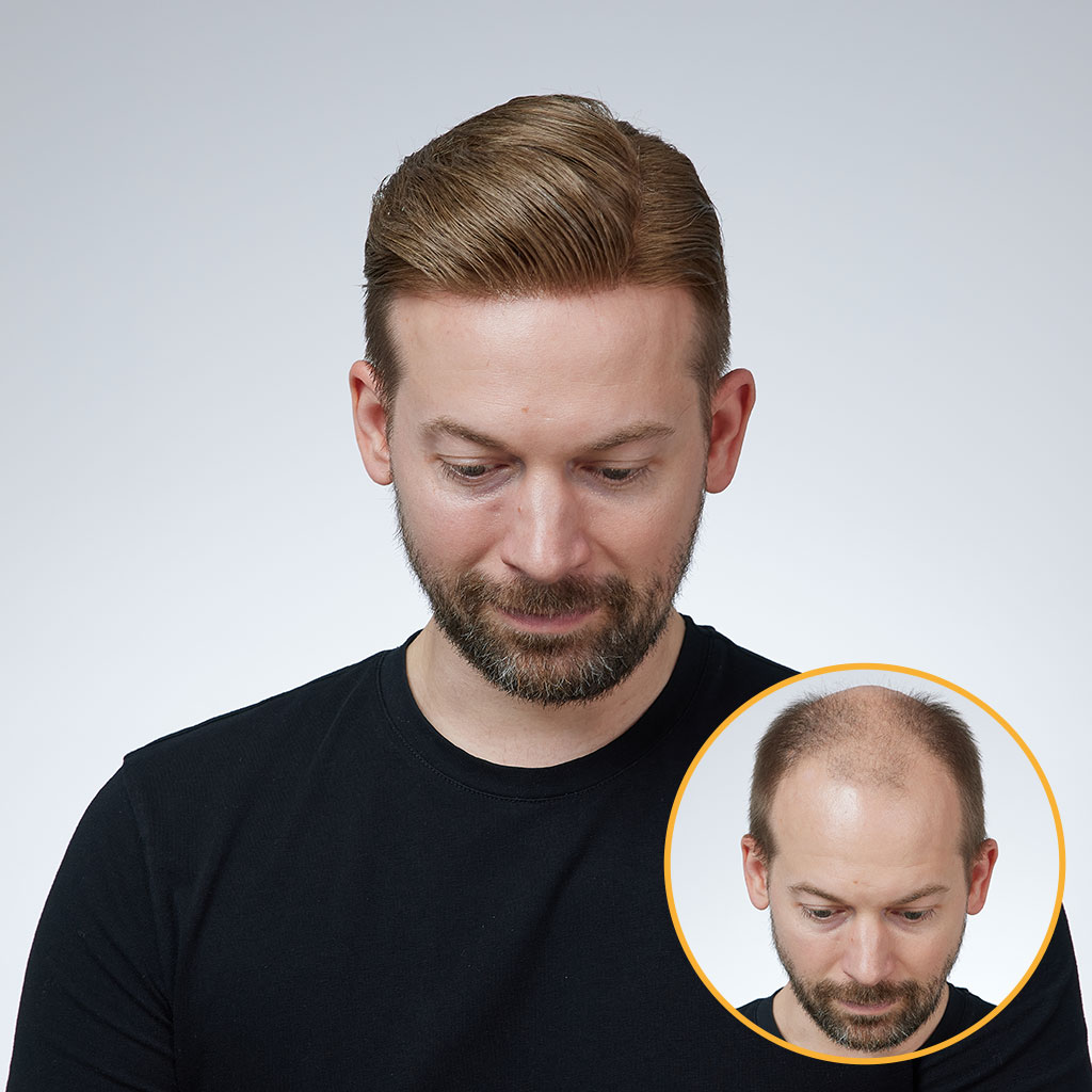 NCONAL Monofilament Toupee for Men order from newtimes hair (11)