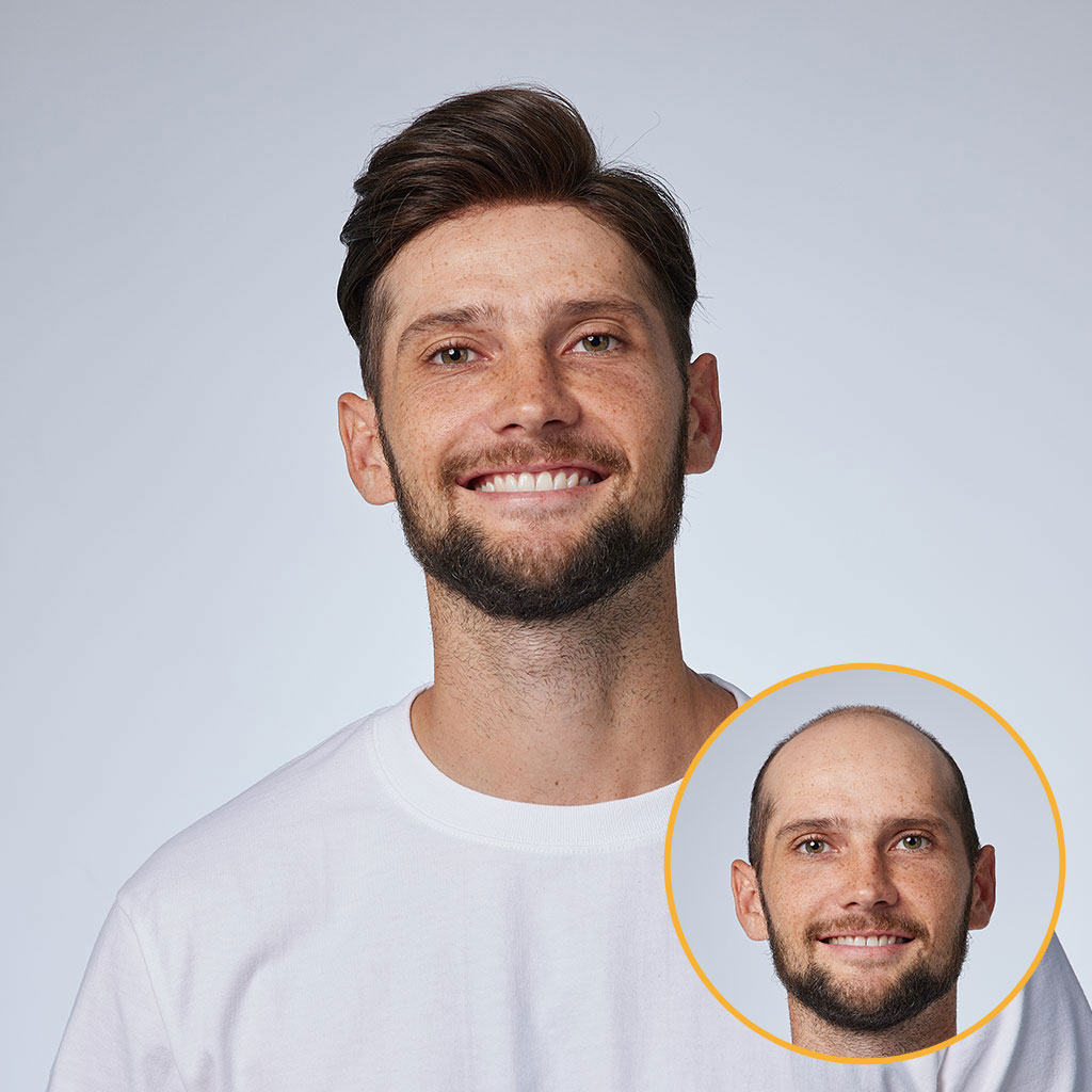 HS1V 0.06mm Thin Skin Hair System with V-Loops All Over (9)