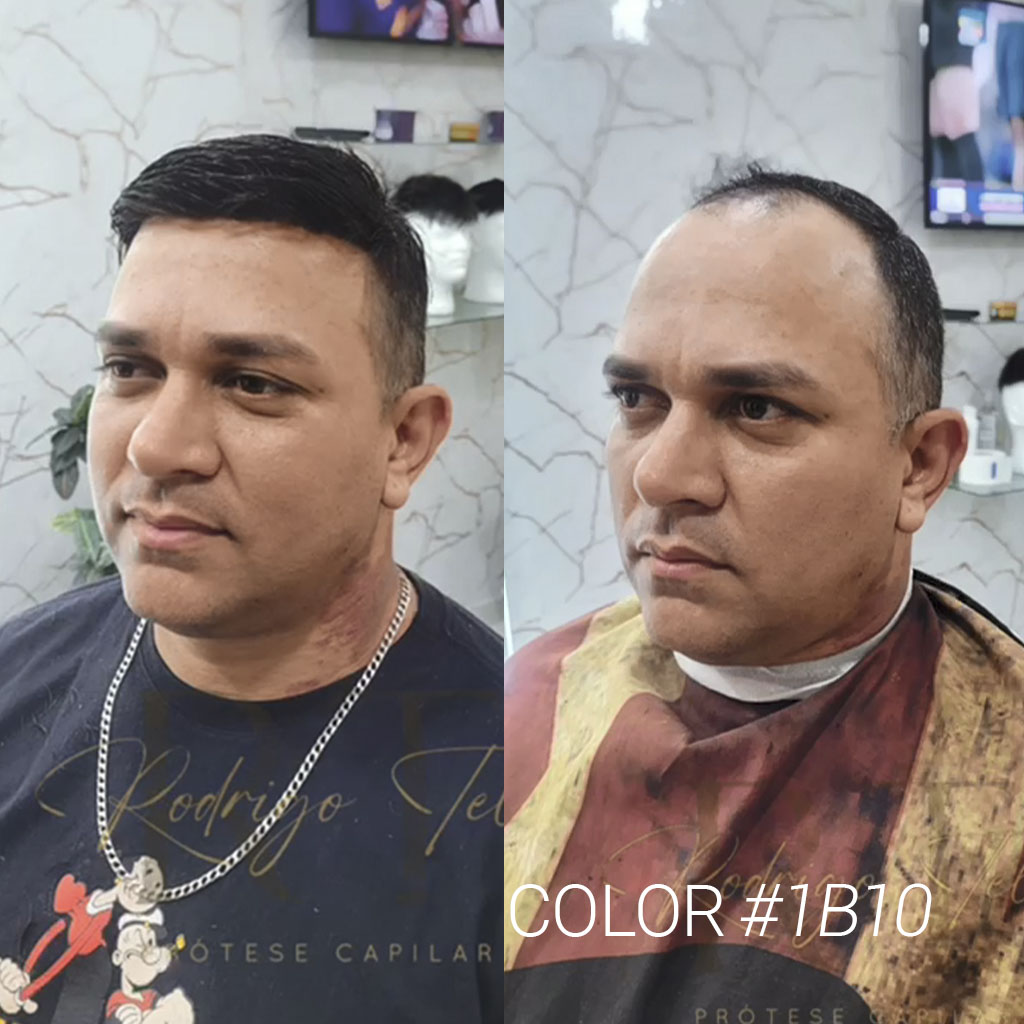 HS25-V0.03mm Ultra Thin Skin Men's Hair Systems With V-looped Human Hair before&after #1B10