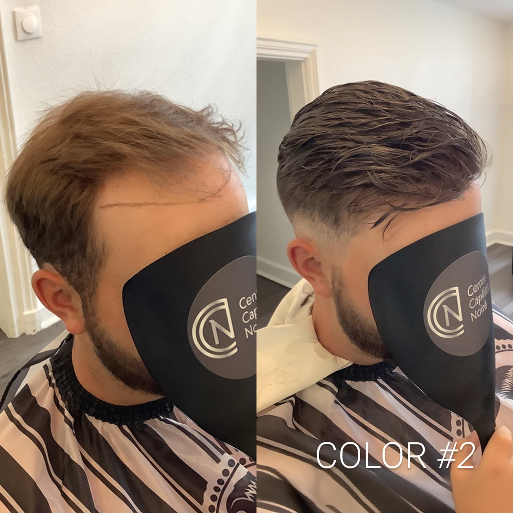 hs1v#2 men's hair system before and after