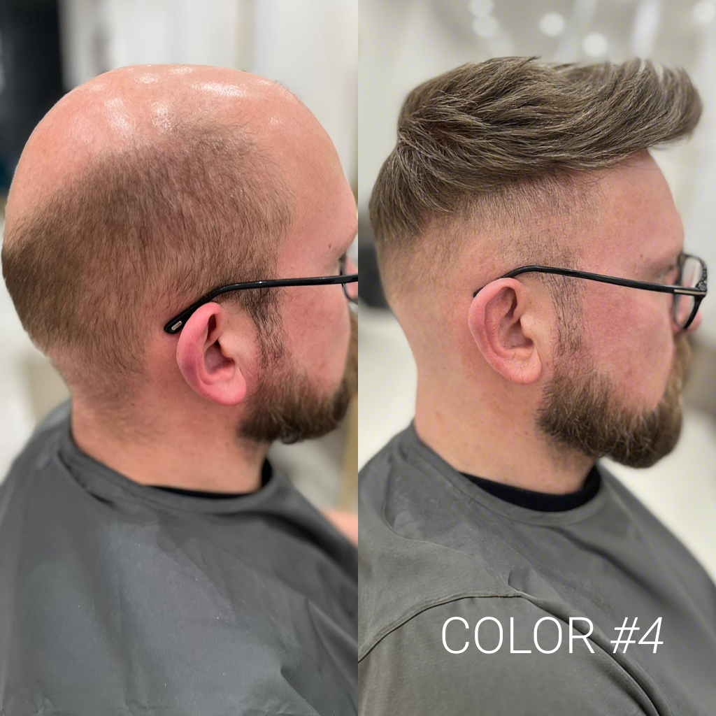 hs1v#4 men's hair system before and after