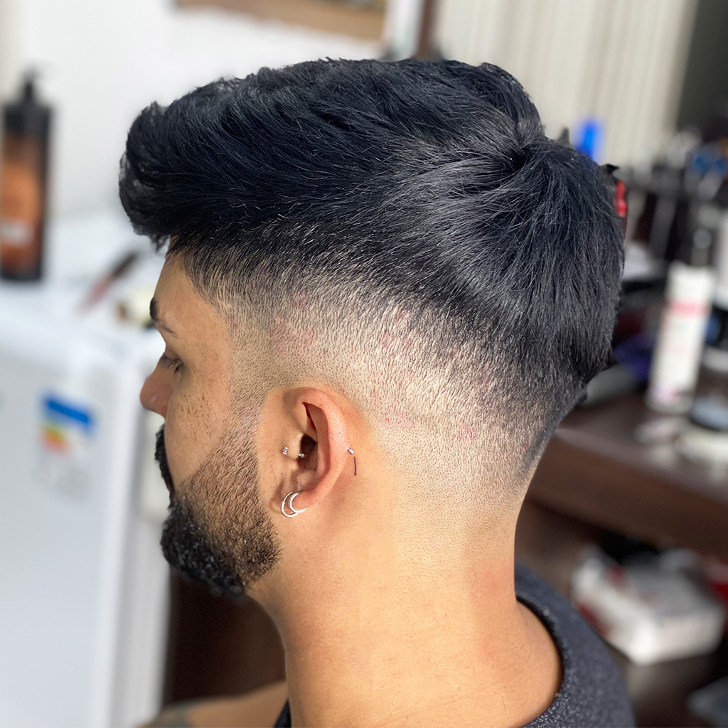 INL-Injected-Thin-Skin-Hair-System-with-Diamond-Net-12