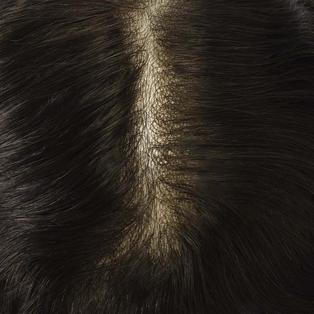 LIGHT03A 0.03mm Thin Skin Hair System With 80% Density (3)