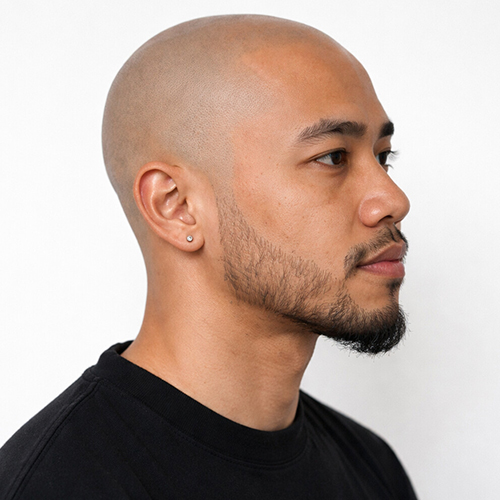 zero length shaved head for a balding top