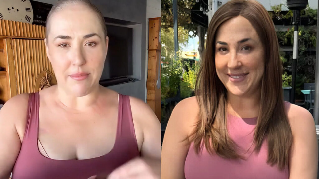 Crown of Courage woman - Tara, before and after wearing a wig