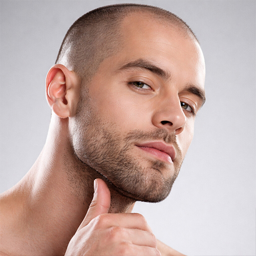 a guy with a fully shaved head with a pigmented effect.