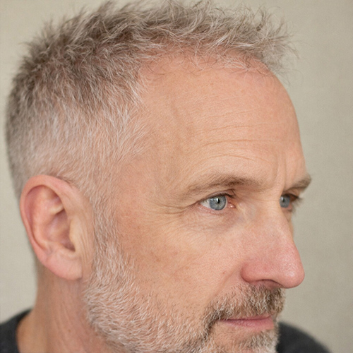 a guy with loose textured crop - one of the most perfect hairstyles for balding men