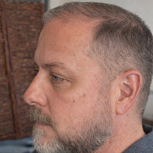 a guy with a short comb over