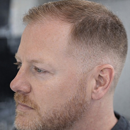 short side part