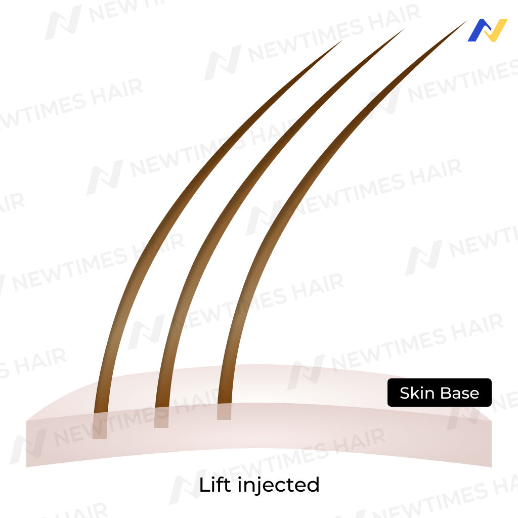 ventilation technique: Lift injected hair