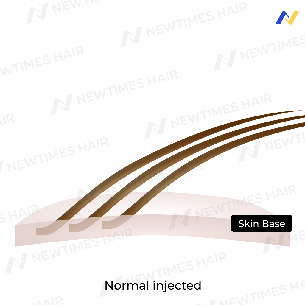 ventilation technique: Normal injected hair